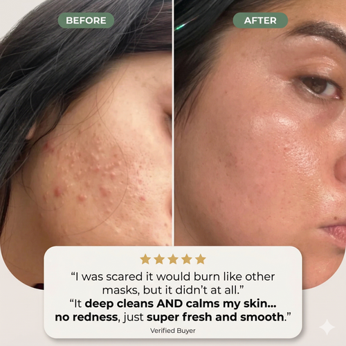 Holy Basil Bubble Deep Mask