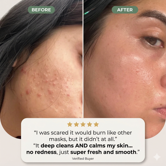 Holy Basil Bubble Deep Mask