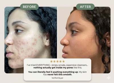 Holy Basil Bubble Deep Mask