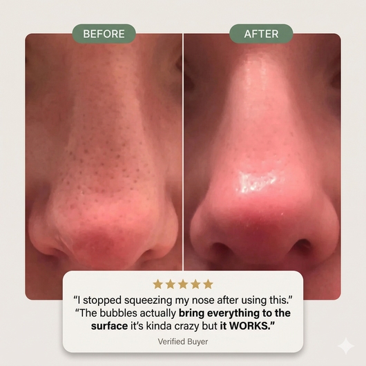 Holy Basil Bubble Deep Mask